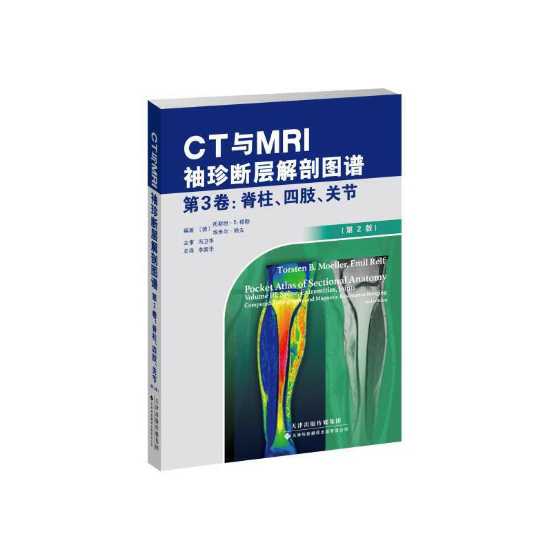 CTcMRIӽʈDV3֫P(ji)2棩