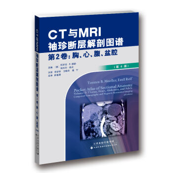 CTcMRIӽʈDV 2-ءǻ