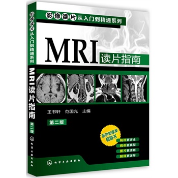 ӰxƬTͨϵ--MRIxƬָ(ڶ)(t(y)W(xu)ӰN(j)ٰNRȫDƬጸԔM)